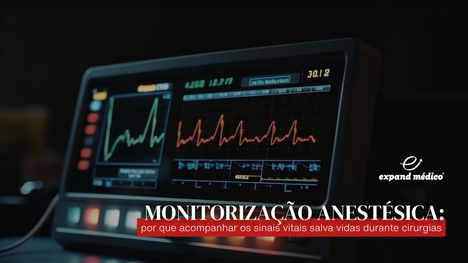Monitorização anestésica por que acompanhar os sinais vitais salva vidas durante cirurgias (1)